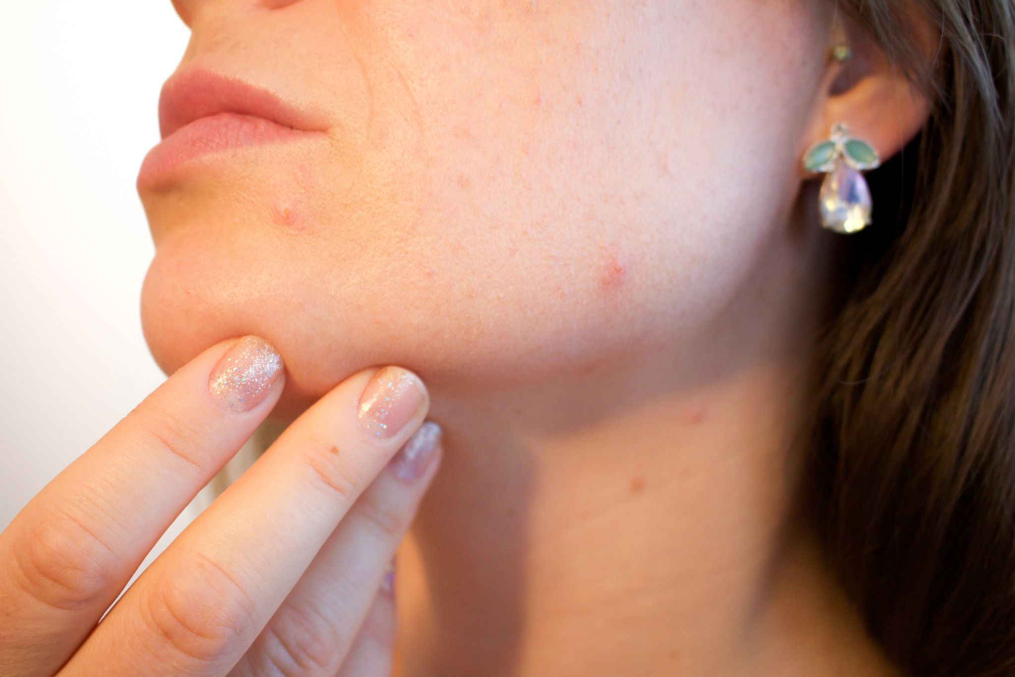 DERMATOLOGÍA Imagem 1